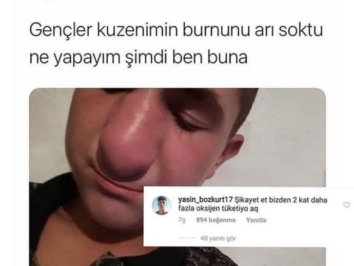 Size hiç arı soktu mu?