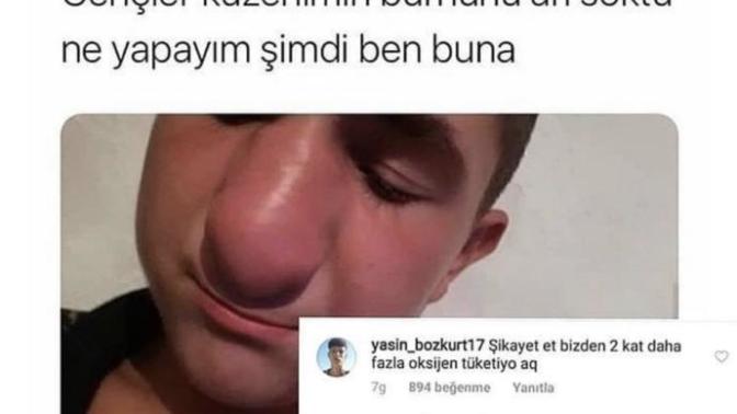 Size hiç arı soktu mu?