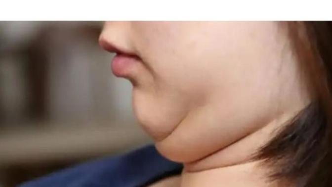 Gıdığı olan kızları nasıl bulursunuz itici mi?