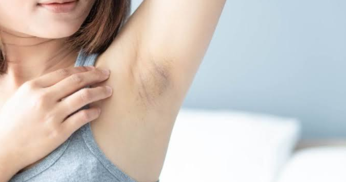 Koltuk Alti Kararmasi Nasil Giderilir Flipboard