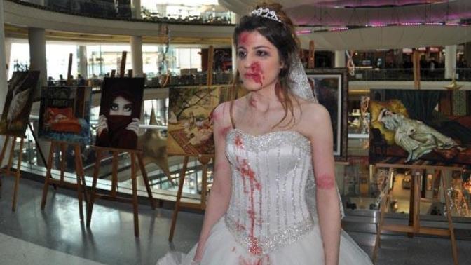 Hatay Belen’de damat, gelini yol ortasında dövdü! Ne düşünüyorsunuz?