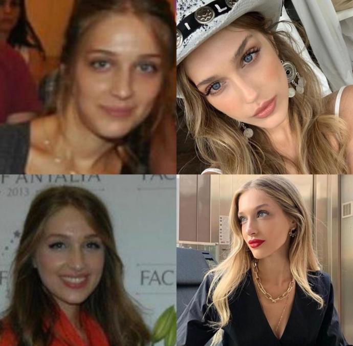 Yaş aldıkça güzelleşen insanların sırrı nedir?