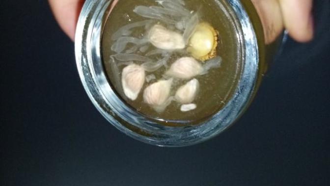 Limonla Hamilelik Testi Yaptım Sizce Sonuç Ne?