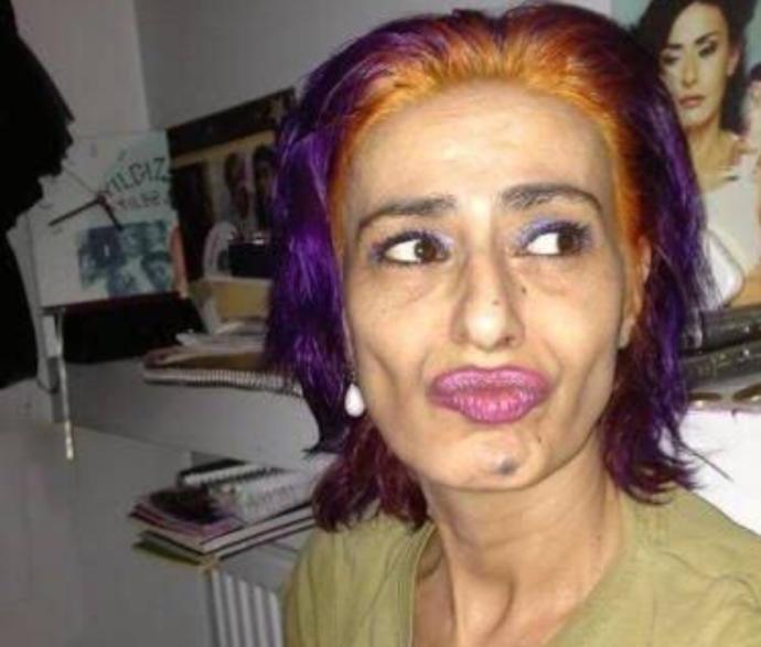 En Yıldız Tilbe özelliğiniz ne?