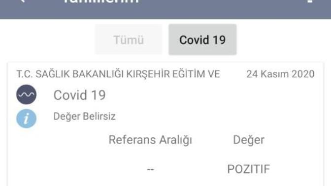 Yedi aydır covid servisinde hemşireyim. Sonunda bana da bulaştı. Dua eder misiniz sorunsuz atlatmam içinn 🌼💉?