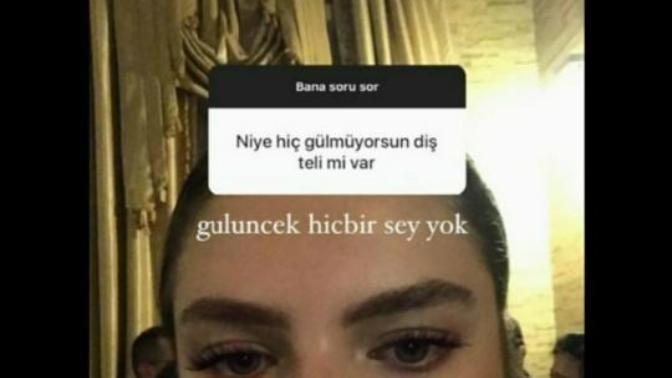Gülmek size yakışıyor mu?
