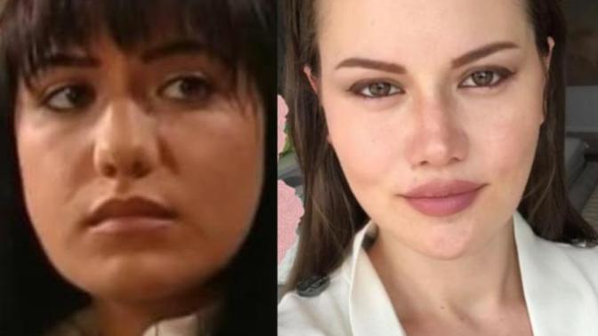 Fahriye Evcen de estetik var mı sizce?