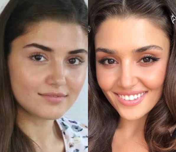 Esra Bilgiç çok güzel dimi?