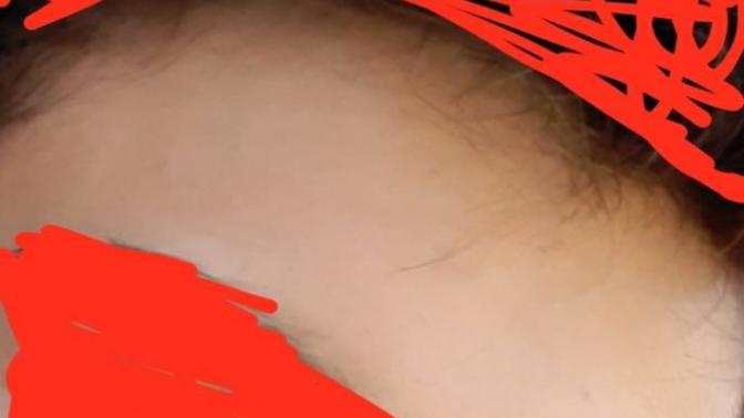 Yüzüm feci oldu bakarmısınız?
