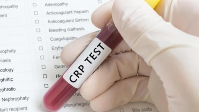 CRP nedir? Neden yükselir, neden düşer bilen var mı?