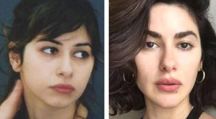 Yüzümden neden kilo alamıyorum?