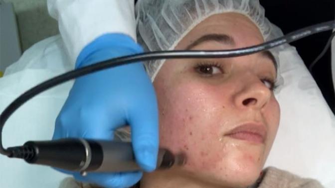 Dermapen hakkında bilgisi olan var mı? 