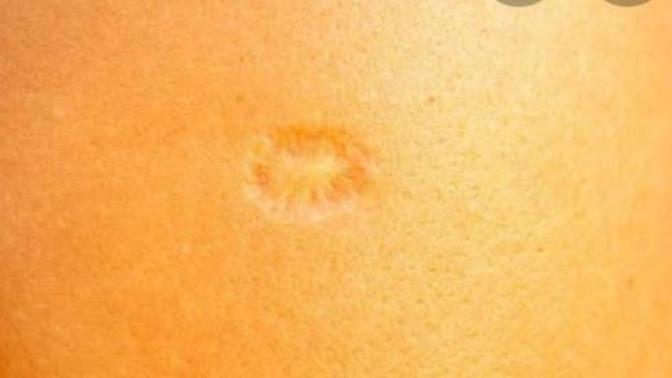 Sol kolunuzda aşı izi var mı?