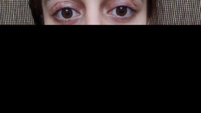 Göxlerime noldu bakın nasil geçer?