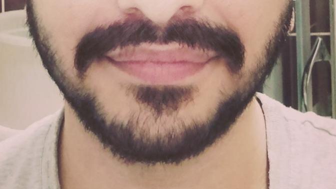 Sakal sorunum var ne yapmalıyım?