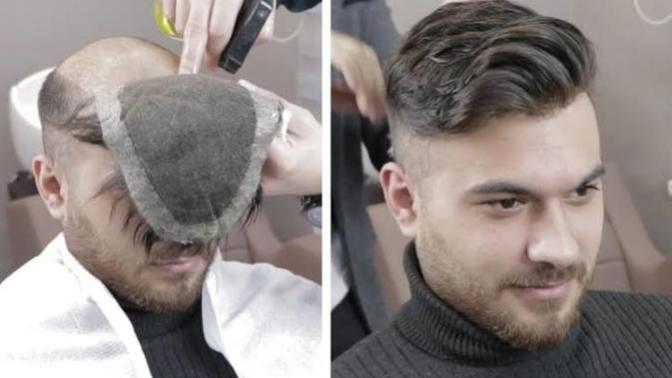 Protez saçı gerçeğinden ayırt etmek mümkün müdür?