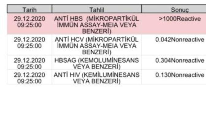 Heptatit tahlillerim anlayan  var mı?