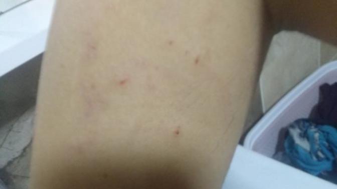 Şiddet görüyorum, sevgilim bundan nasıl vazgeçer?