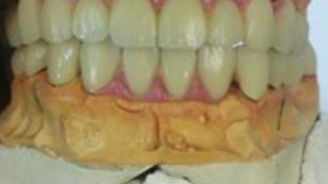 Diş teknisyeniyim soruları alayım?