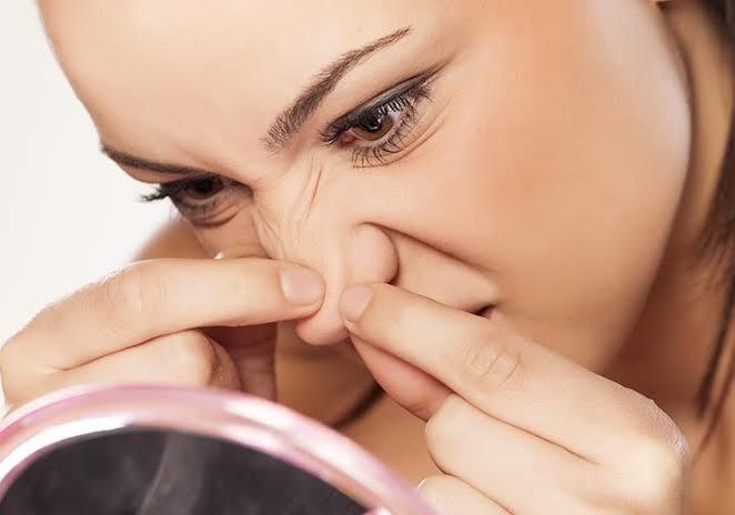 Burunda Çıkan Sivilceler için Çözüm Var mı? Nasıl Geçer?