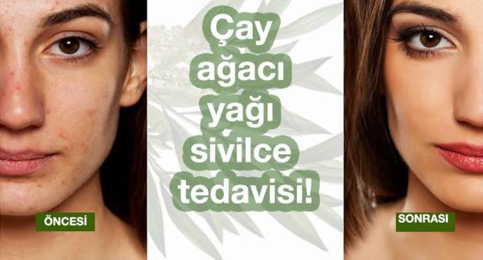 Çay Ağacı Yağı