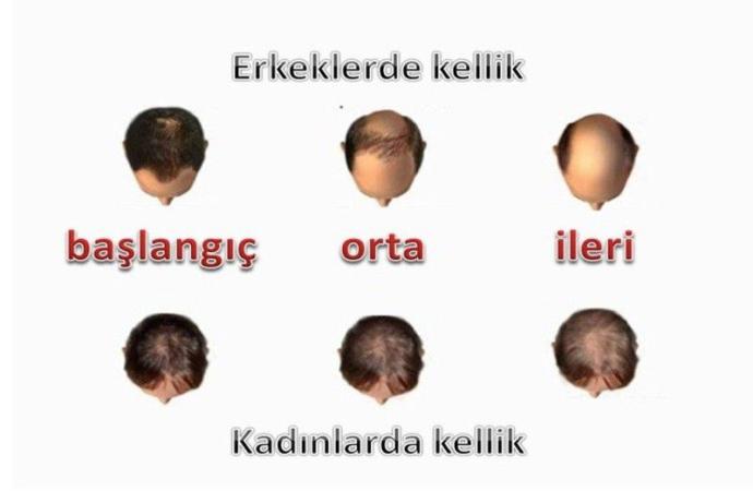 kellik