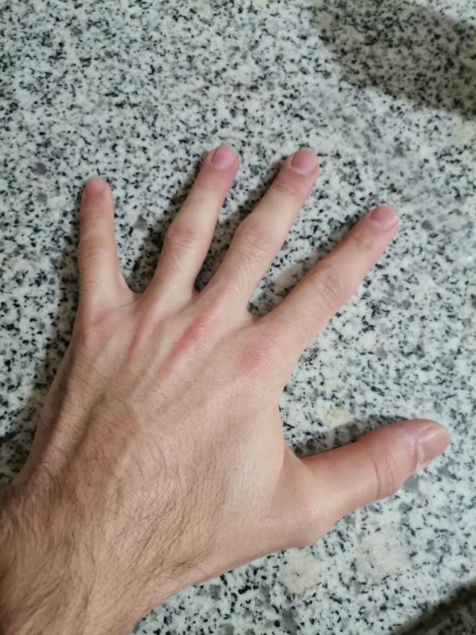 Elleriniz güzel mi?