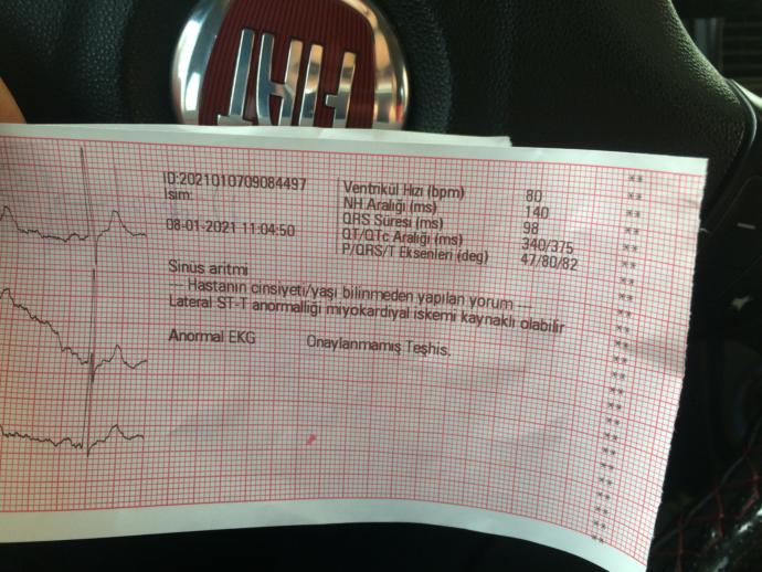 EKG çektirdim bu yazılar ne manaya geliyor?