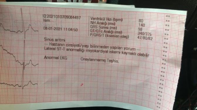 EKG çektirdim bu yazılar ne manaya geliyor?