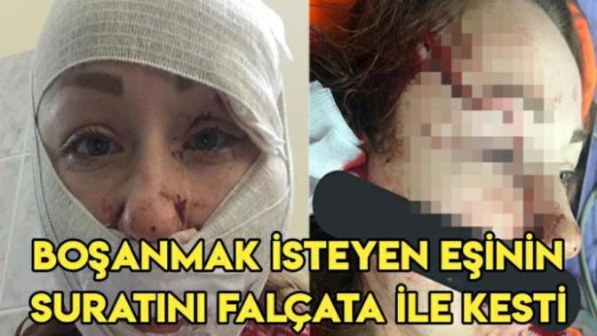Boşanmak isteyen eşinin yüzünü falçata ile kesti. Kadına şiddet ne zaman son bulacak?