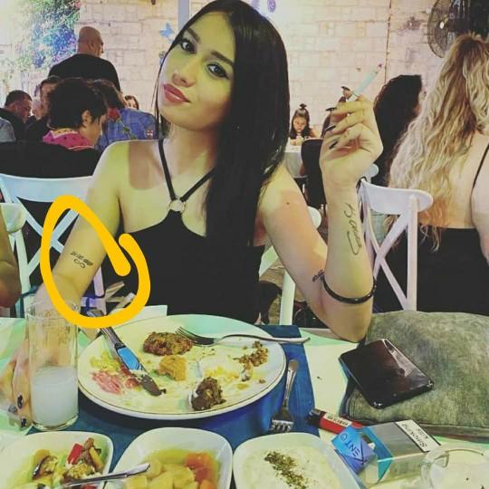 Daha önce dövme sildiren var mı?