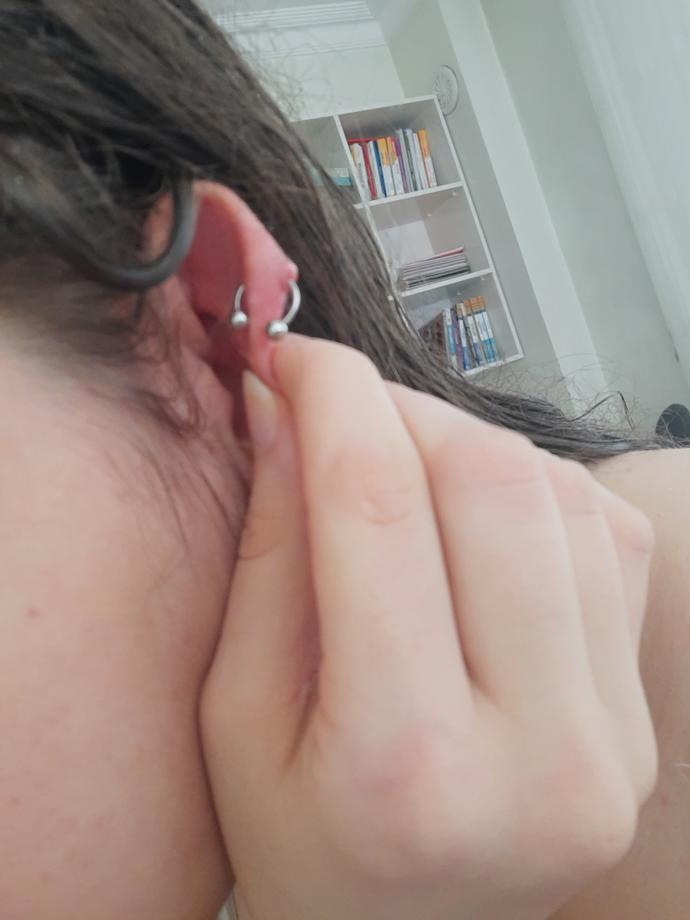 Kulağımdaki piercing yeri çok şişti?