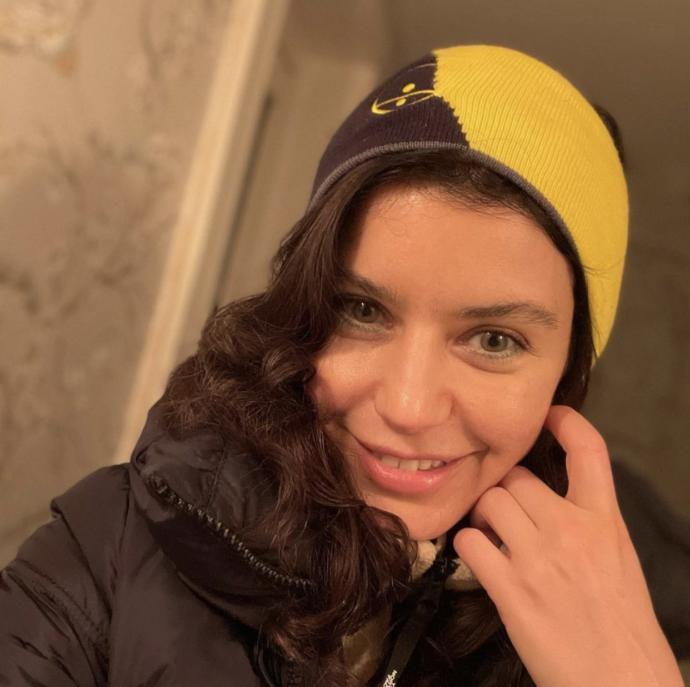 Beren Saat’in ağzı büyük mü?