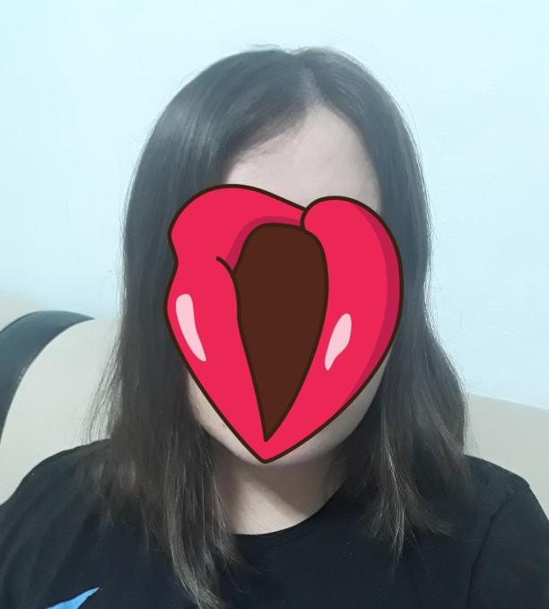 Saçımın ortası çok mu kel?