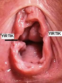 Kızlık zarının bozulup bozulmadığıni nasıl anlarız?