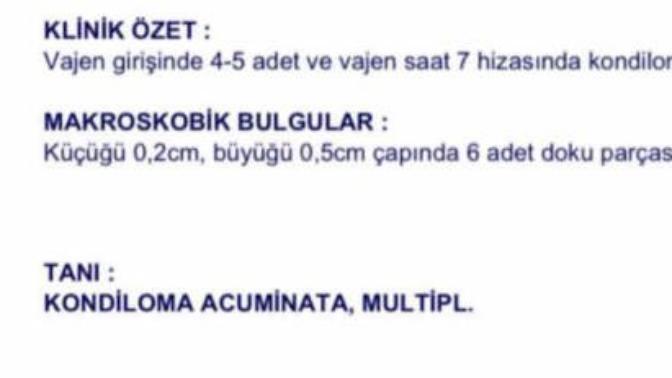Biyopsi patoloji sonucundan anlayan  var mı  kansermiyim?