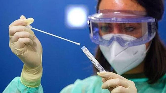 Çin, Covid-19 tanısı için anal test kullanmaya başladı. Bu uygulama bizde olsa kurallara uyum artar mıydı?