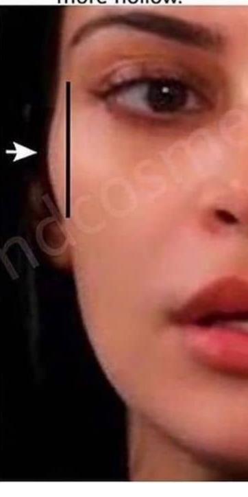 Değişik bir yüz tipine sahip olanlar var mı?