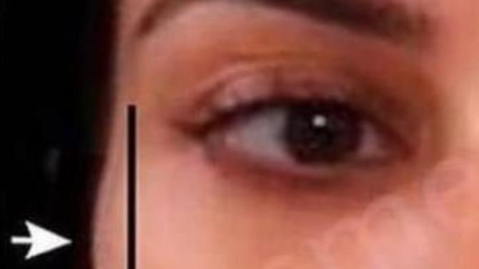 Değişik bir yüz tipine sahip olanlar var mı?