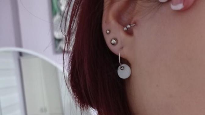 İyileşmeyen tragus?