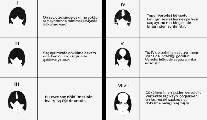 Kadınlarda erkek tipi saç dökülmesi?