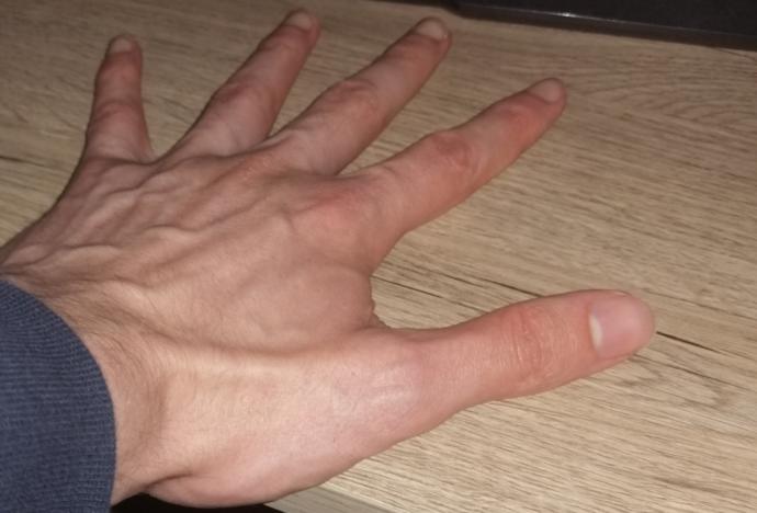 Taciz ediliyorsanız ne yaparsınız?