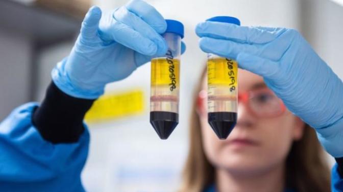 Oxford-AstraZeneca aşısının 65 yaş üstü için etkisiz olduğu açıklandı. Aşı olup olmama kararınız değişti mi?