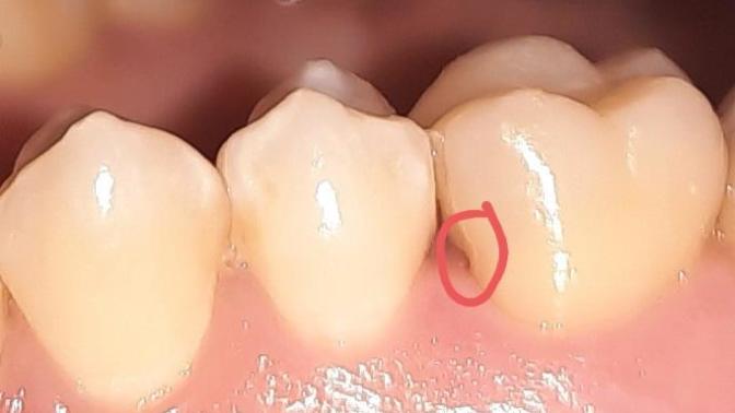 Orası çürük mü yani kararma mı var kavis gibi duruyor lütfen bakar mısınız?