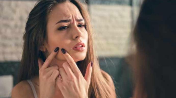 Siyah nokta sıkmanın cilde ne gibi zararları olabilir?