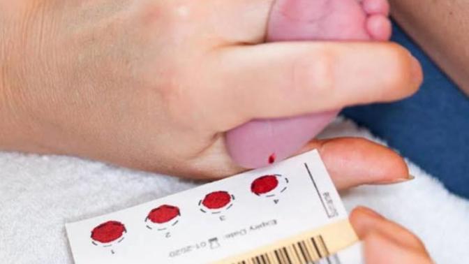 Bebeklerden topuk kanı almanın sebebi nedir?