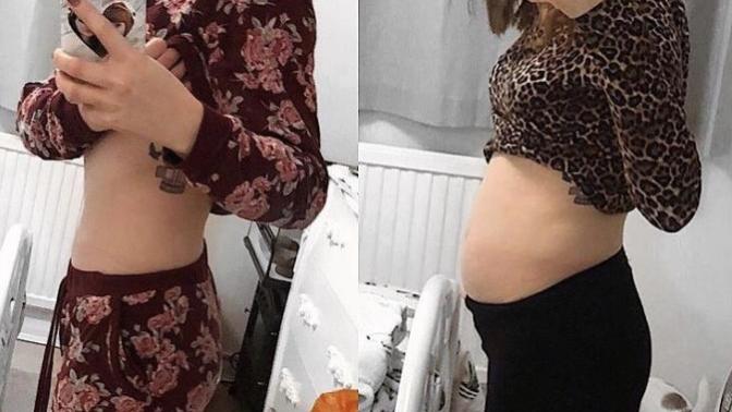 Sabahları karnım soldaki gibi ama akşamları sağdaki fotoğraftaki gibi oluyo. Sizde de şişkinlik oluyo mu yemek yiyince gün içinde?