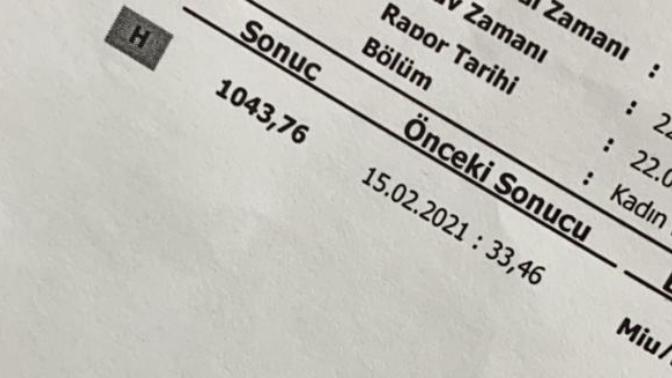 Kızlar beta değerinden anlayanlar?