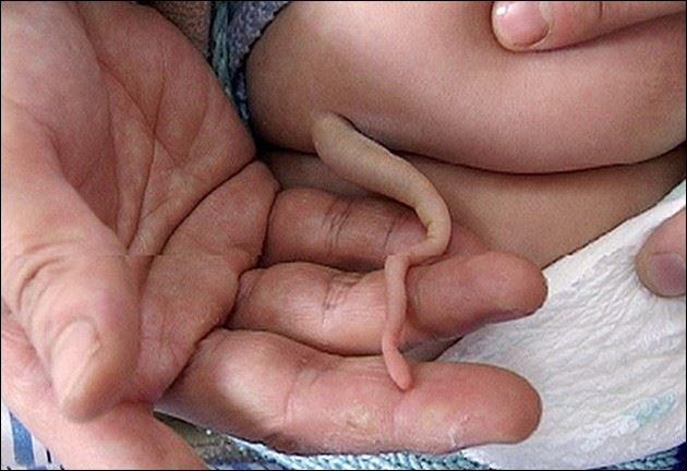 Bazı bebekler kuyruklu doğar, anne karnında 1. ayda kuyruğu atamazlar. Bizdeki kuyruk sokumu zaten bunu göstermektedir. Körelmiş organdır.