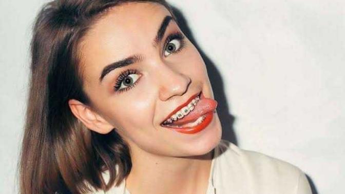 Diş telleri oral sekse engel midir?